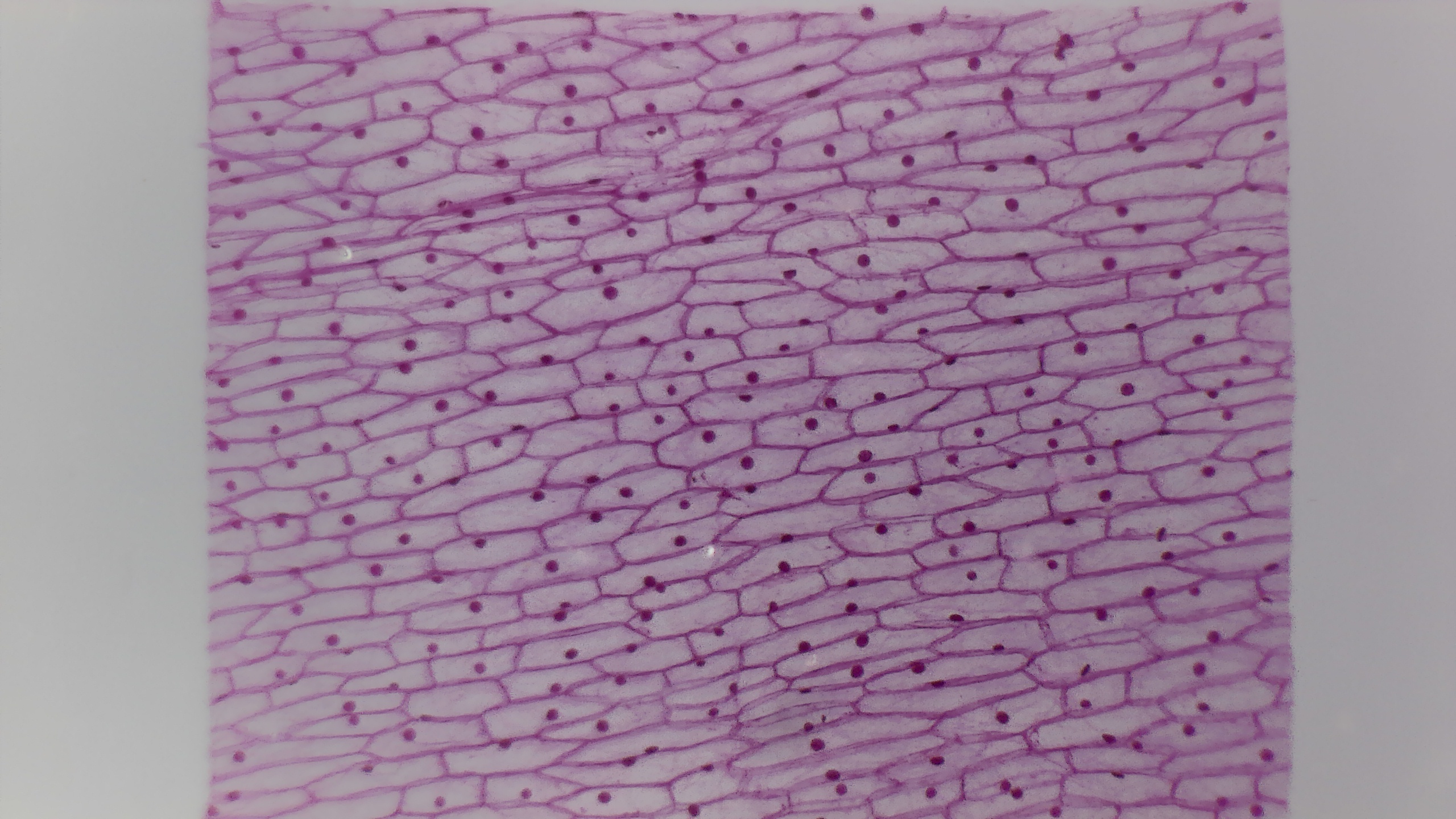 Onion Epidermis