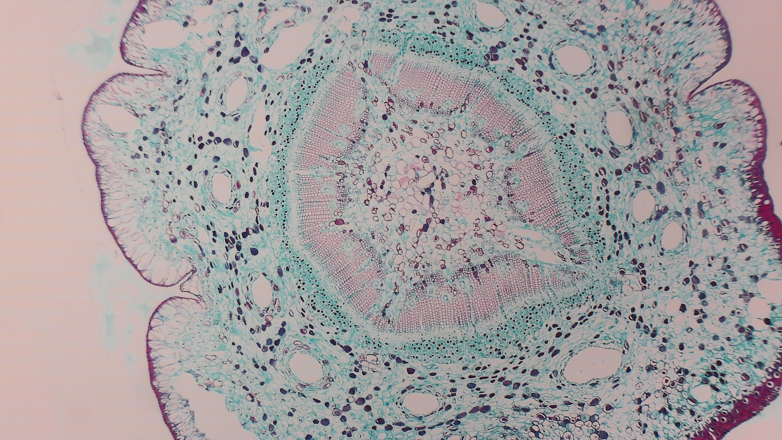 Pine Stem Cross-Section